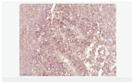 6052b7f6da933.png image.png